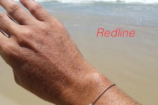 Un Redline en vacances …